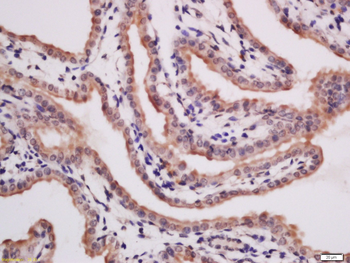 SFXN3 Rabbit Polyclonal Antibody