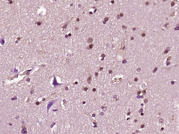 Sialidase 3 Rabbit Polyclonal Antibody