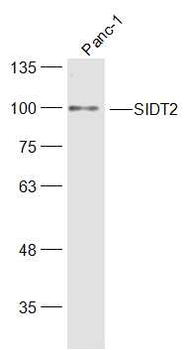 SIDT2 Rabbit Polyclonal Antibody
