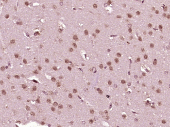SKOR1 Rabbit Polyclonal Antibody