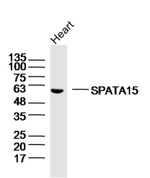 SPATA15/SPATC1 Rabbit Polyclonal Antibody