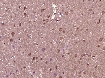 SPG11 Rabbit Polyclonal Antibody