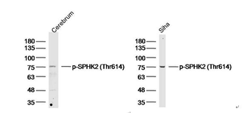 Phospho-SPHK2 (Thr614) Rabbit Polyclonal Antibody