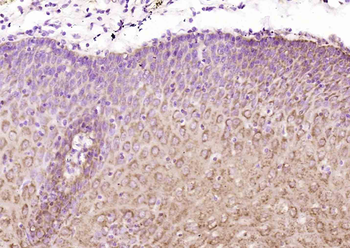 SPINK5/LEKTI Rabbit Polyclonal Antibody