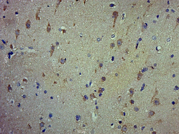 SPINK8 Rabbit Polyclonal Antibody