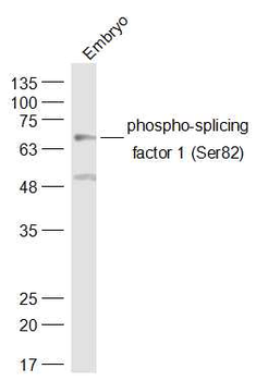 Phospho-SF1 (Ser82) Rabbit Polyclonal Antibody