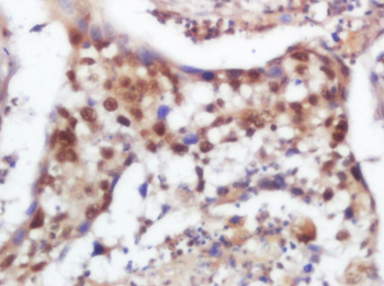 SOX9 Rabbit Polyclonal Antibody