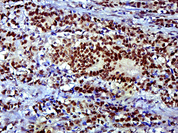 SOX9 Rabbit Polyclonal Antibody