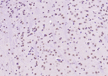 SOX9 Rabbit Polyclonal Antibody