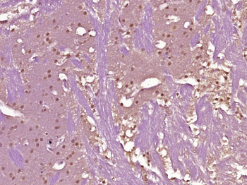 Phospho-MDMX (Ser367) Rabbit Polyclonal Antibody