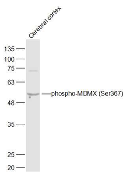 Phospho-MDMX (Ser367) Rabbit Polyclonal Antibody