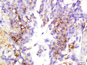 TSPAN12 Rabbit Polyclonal Antibody