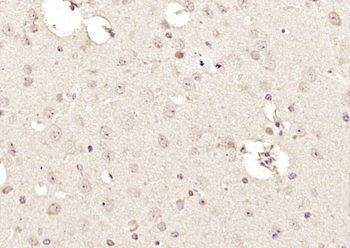 TIMM23 Rabbit Polyclonal Antibody