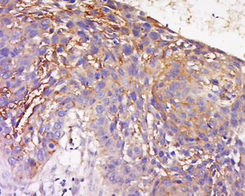 TRAM1 Rabbit Polyclonal Antibody