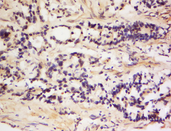 Translin Rabbit Polyclonal Antibody