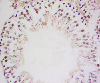 Translin Rabbit Polyclonal Antibody