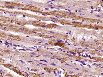 TRAPPC6B Rabbit Polyclonal Antibody