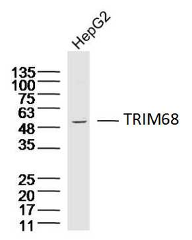 TRIM68 Rabbit Polyclonal Antibody