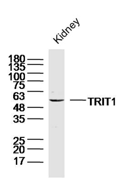 TRIT1 Rabbit Polyclonal Antibody