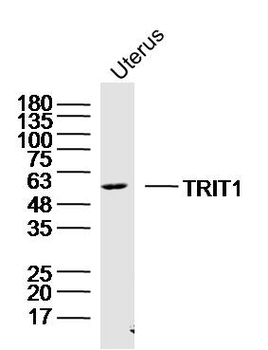 TRIT1 Rabbit Polyclonal Antibody