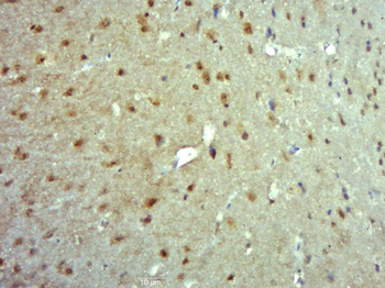 TRMT1 Rabbit Polyclonal Antibody