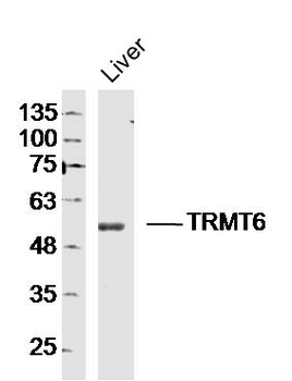 TRMT6 Rabbit Polyclonal Antibody
