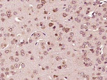 TPA Rabbit Polyclonal Antibody