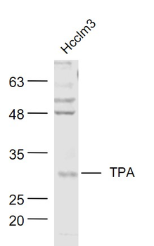 TPA Rabbit Polyclonal Antibody