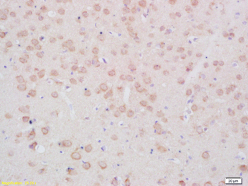 Phospho-TPH2 (Ser19) Rabbit Polyclonal Antibody