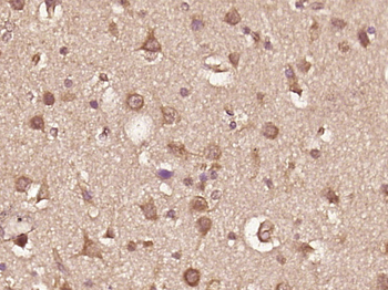 TPRG1 Rabbit Polyclonal Antibody