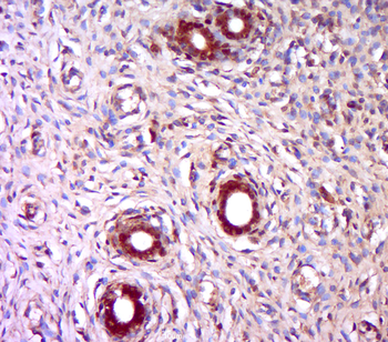 TPRKB Rabbit Polyclonal Antibody