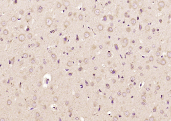 TOMM40 Rabbit Polyclonal Antibody