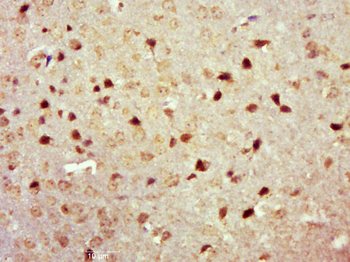 Phospho-TrkA (Tyr490) Rabbit Polyclonal Antibody