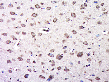 Phospho-TrkA (Tyr490) Rabbit Polyclonal Antibody