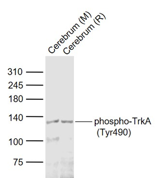 Phospho-TrkA (Tyr490) Rabbit Polyclonal Antibody