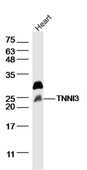 TNNI3 Rabbit Polyclonal Antibody