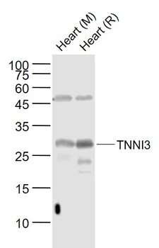 TNNI3 Rabbit Polyclonal Antibody