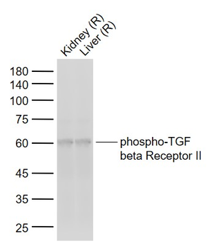 Phospho-TGF beta Receptor II (Tyr336) Rabbit Polyclonal Antibody