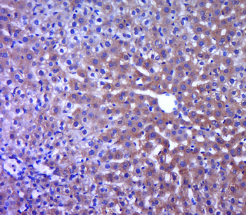 TNNC2 Rabbit Polyclonal Antibody