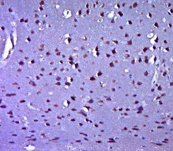 TNRC5/PRAT4A Rabbit Polyclonal Antibody