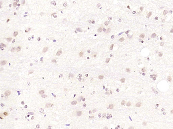 TOB Rabbit Polyclonal Antibody