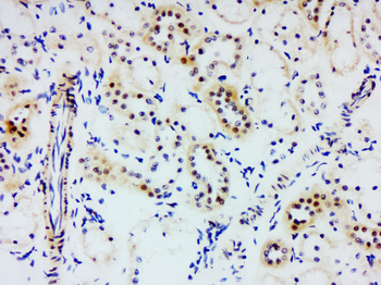 UHRF1BP1 Rabbit Polyclonal Antibody