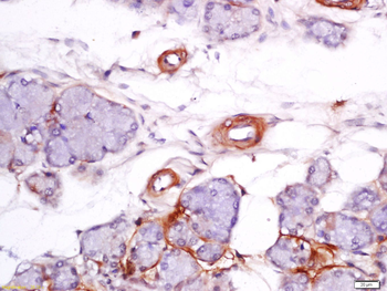 VEGF-D Rabbit Polyclonal Antibody