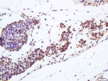 Vitamin D Receptor Rabbit Polyclonal Antibody