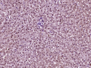 ZC3H7A Rabbit Polyclonal Antibody