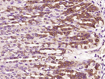 ZDHHC13/HIP14L Rabbit Polyclonal Antibody