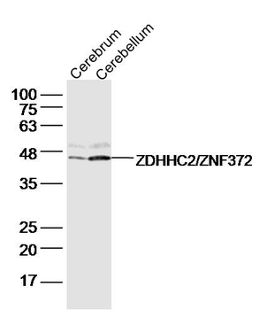 ZDHHC2/ZNF372 Rabbit Polyclonal Antibody