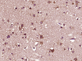 ZC3HAV1L/C7orf39 Rabbit Polyclonal Antibody