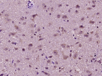 Phospho-14-3-3 beta + zeta (Ser186 / Ser184) Rabbit Polyclonal Antibody