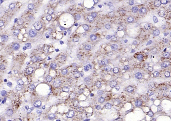 TFRC Rabbit Polyclonal Antibody